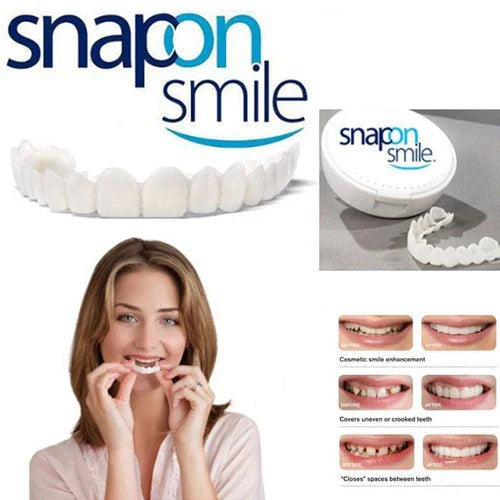 Facettes Dentaires Silicone - Sourire Parfait Instantané